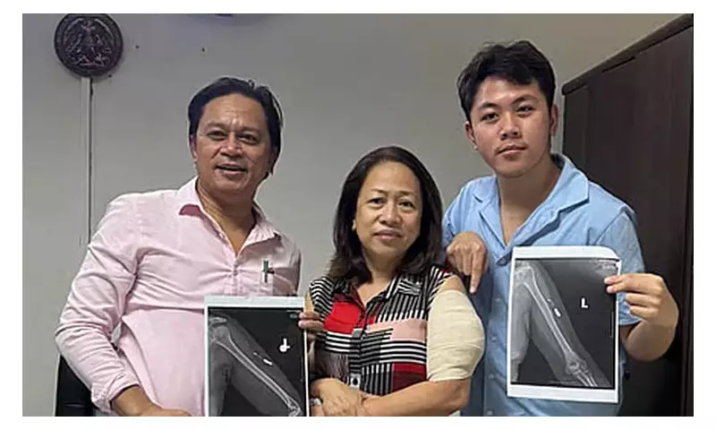 Cebu Official Finally Removes 2019 Ambush Bullet After 6 Years