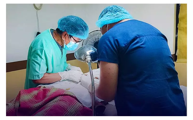 Davao City Clarifies: Vasectomy is Safe, Effective, and Free Since 2008