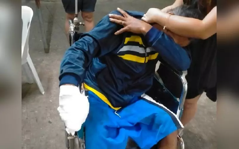 Two Minors Lose Fingers in Firecracker Blasts Ahead of New Year