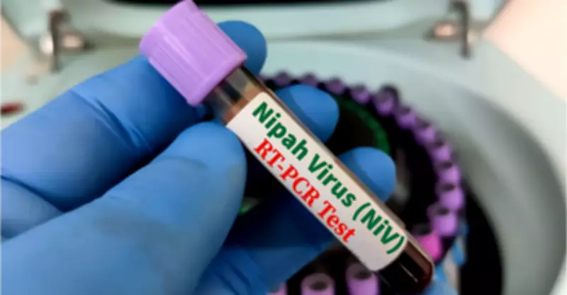 DOH Assures Public of Preparedness Against Nipah Virus Amid Global Concerns