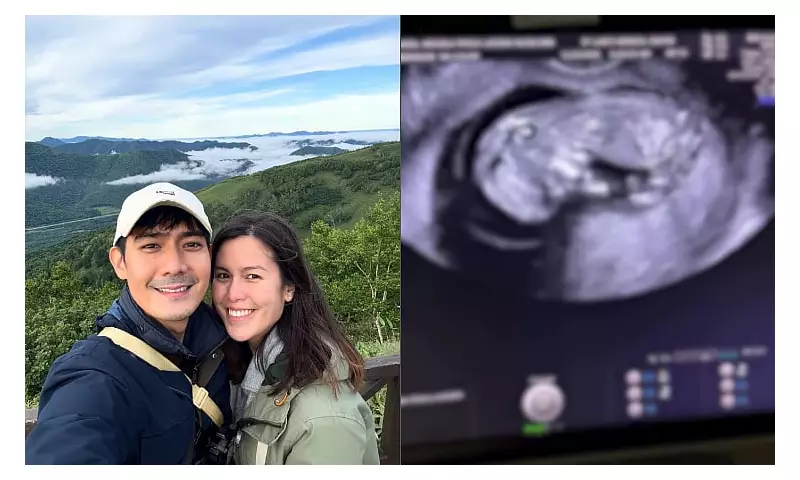 Robi Domingo and Wife Maiqui Expecting First Child on 2nd Anniversary