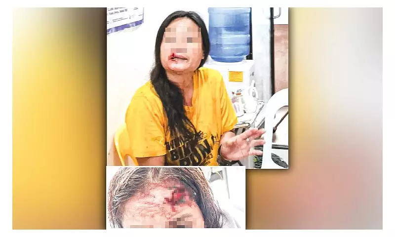 Woman's Forehead Flesh Torn in Bizarre Biting Attack in Cebu