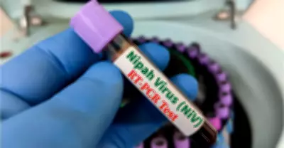 Philippines on High Alert for Nipah Virus Despite No Local Cases Detected