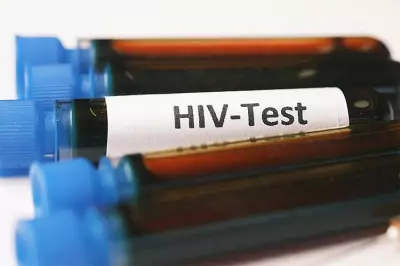 DOH Sets P2,800 Price Cap for HIV Confirmatory Tests to Ensure Equitable Access