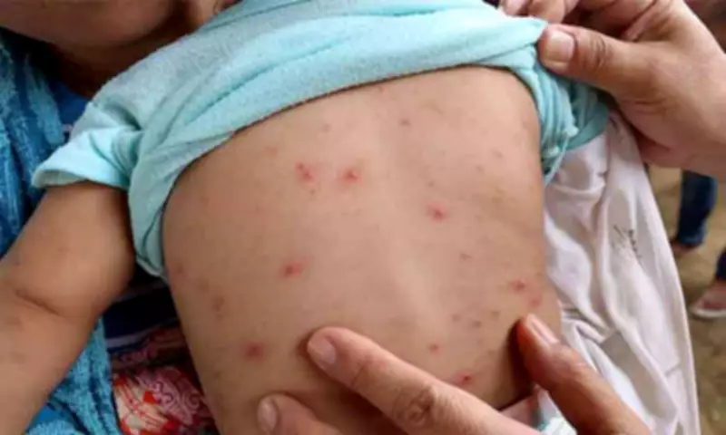 Davao Councilor Seeks Inquiry into Skin Clinic Safety After Fatal Overdose