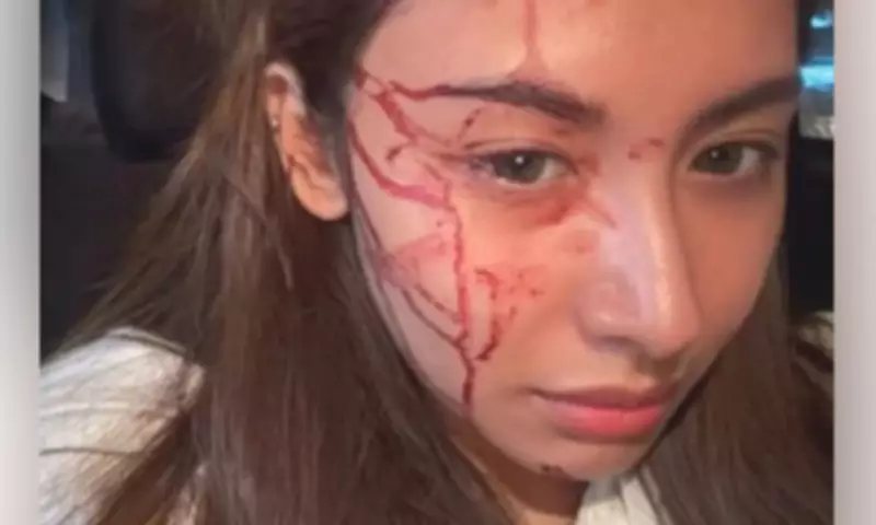 Kapuso Star Thea Astley Rushed to ER After Bathroom Fall, Proceeds with Concert