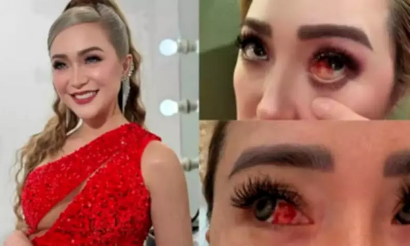 Kitkat Favia Reveals Ruptured Eye Blood Vessels Due to Extreme Heat