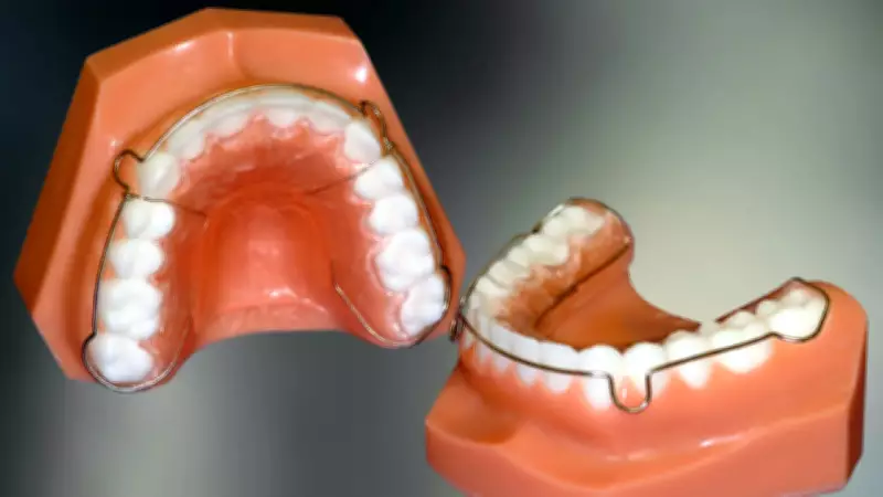 Man in Pampanga Accidentally Swallows Braces Wire While Eating Kakanin