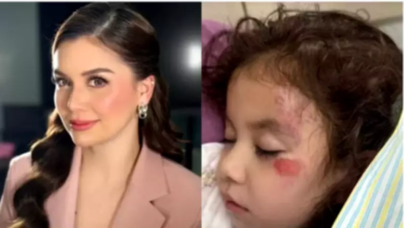 Nadine Samonte's Daughter Hospitalized After School Accident, CT Scan Shows No Serious Injury