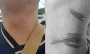 Davao City Councilor Urges Kite Safety Rules After Rider Injured