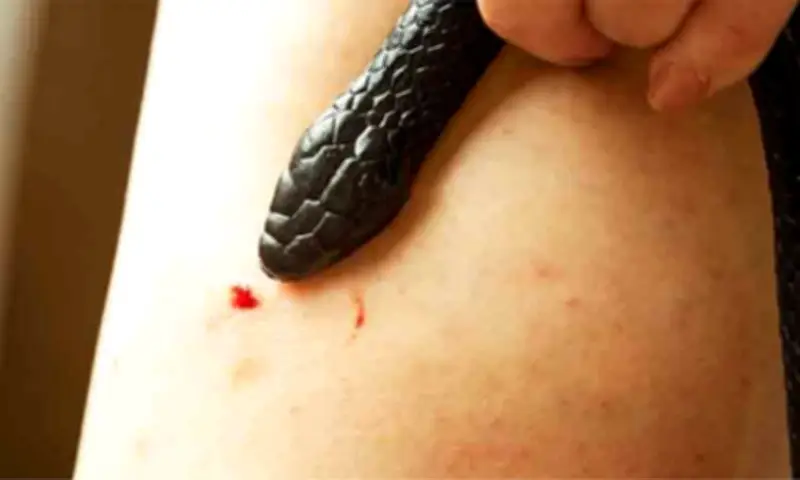 SPMC Urges Immediate Hospital Care for Snakebite Victims Amid Rising Cases
