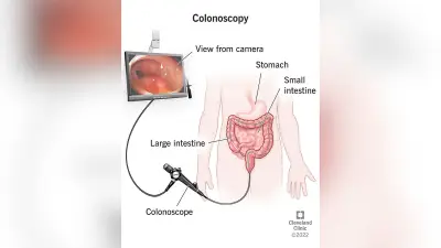 Why Normal Tumor Markers Still Require a Colonoscopy: Dr. Fritz Explains