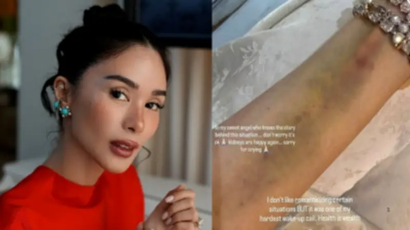 Heart Evangelista discharged from hospital, warns against overfatigue